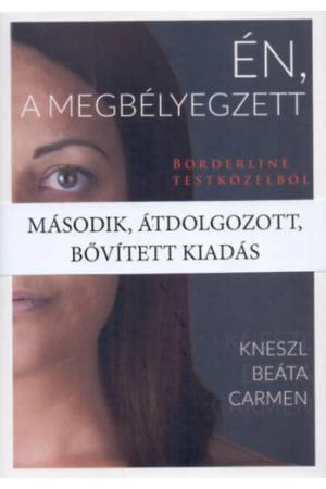 Én, a megbélyegzett - Borderline testközelből