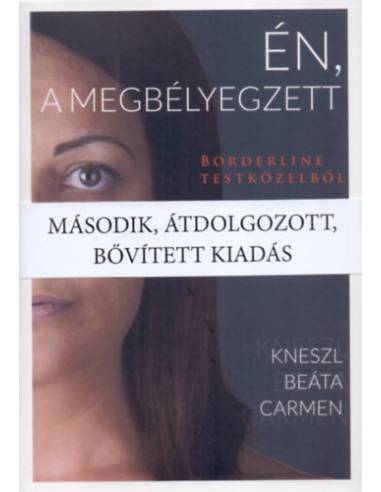 Én, a megbélyegzett - Borderline testközelből