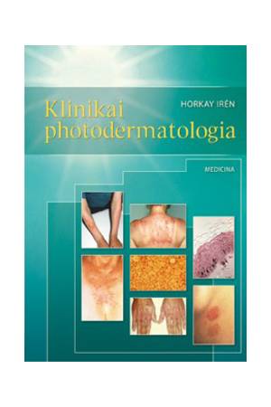 Klinikai photodermatologia
