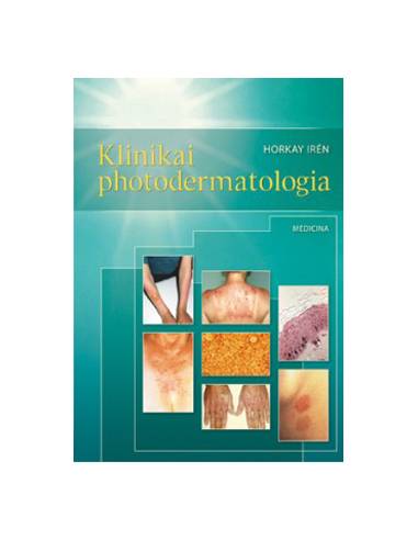 Klinikai photodermatologia