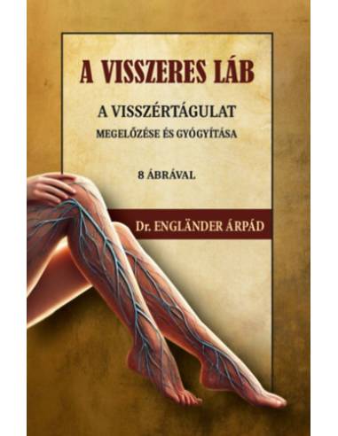 A visszeres láb a visszértágulat megelőzése és gyógyítása