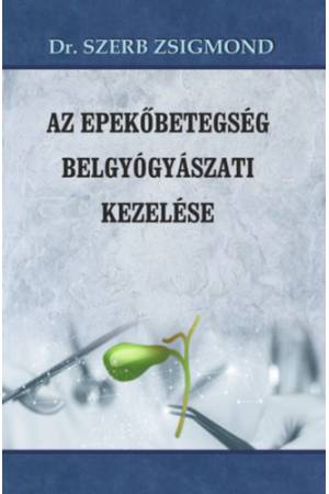 Az epekőbetegség belgyógyászati kezelése